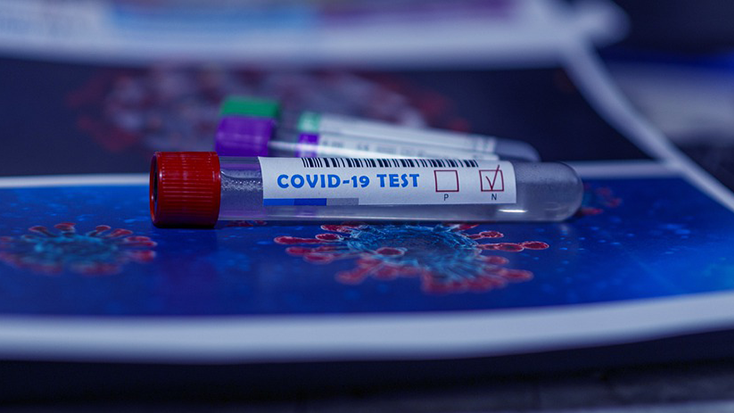 A la regió Occitanie ja s’han realitzat 52.693 test de coronavirus 